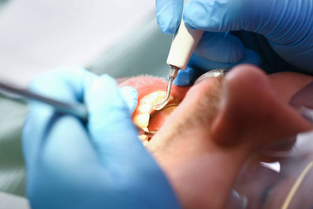 Best After-Hours Dental Trauma Care in Macon, GA