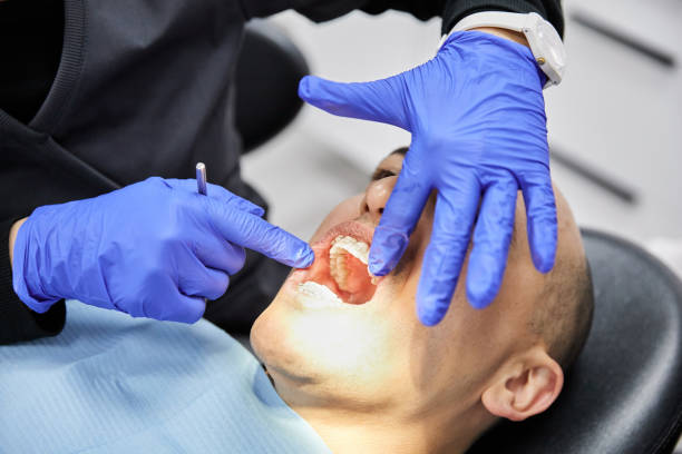 Best Emergency Root Canal Treatment in Macon, GA