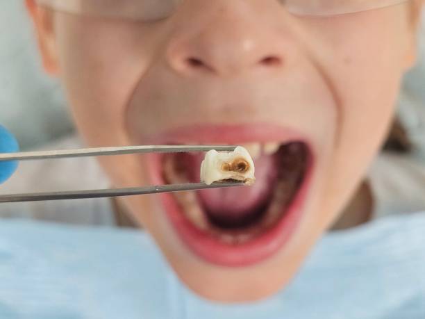 Best Same-Day Emergency Dental Services in Macon, GA